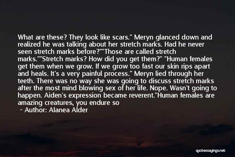 Scars Stretch Marks Quotes By Alanea Alder