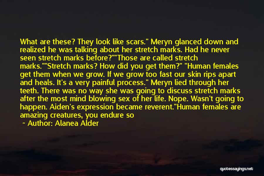 Skin And Scars Quotes By Alanea Alder