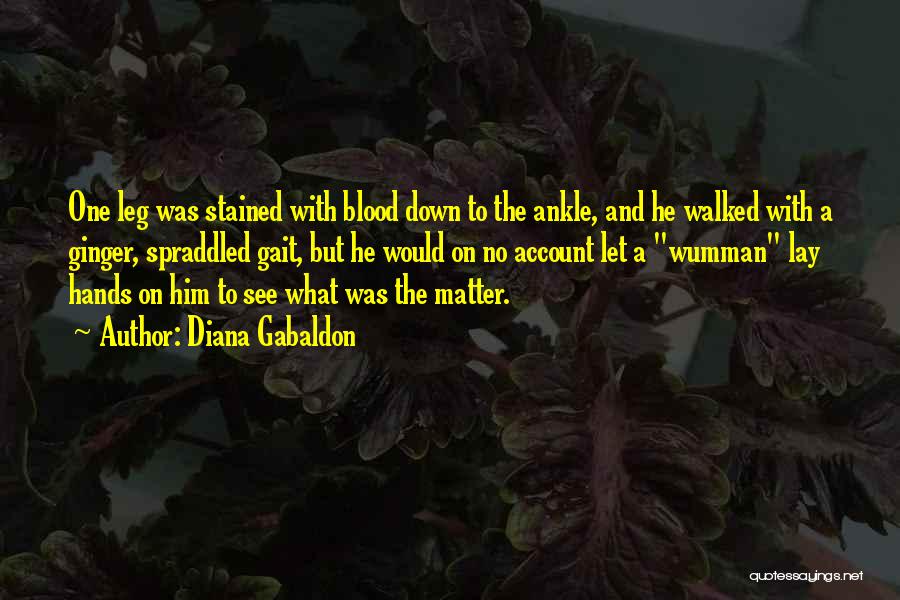 Stained Hands Quotes By Diana Gabaldon