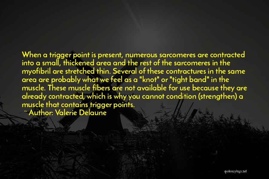 Trigger Point Quotes By Valerie Delaune