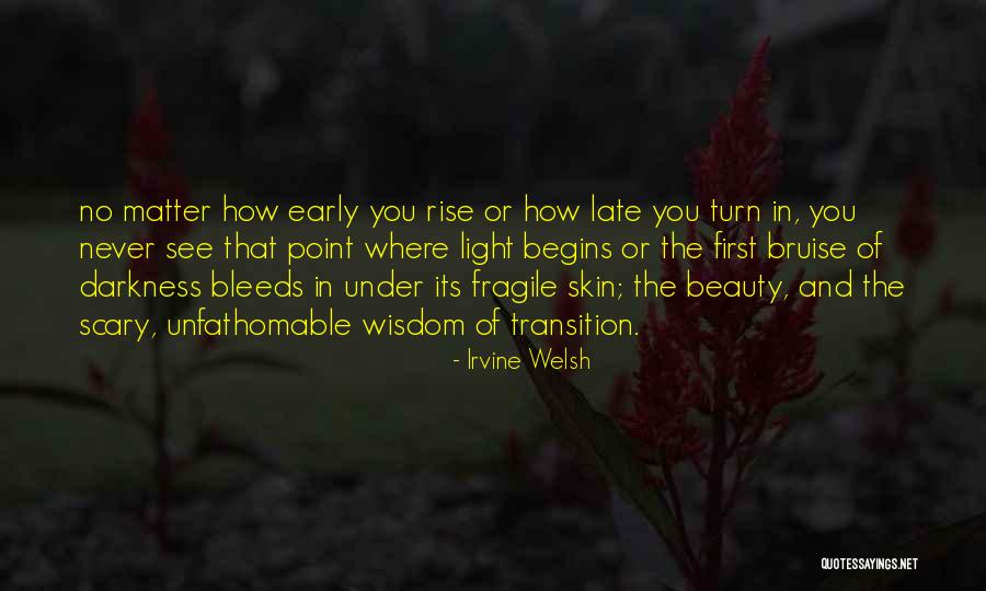 Wisdom And Beauty Quotes By Irvine Welsh